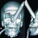'Miracle' Saved Teenager's Eye After He's Assaulted by Metal Chair (PIC)