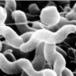 Worlds sickest food borne illnesses 